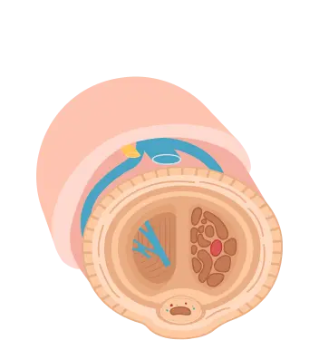 cuerpos cavernosos antes